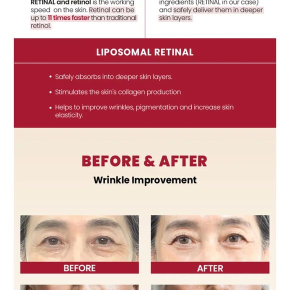 KSECRET, SEOUL 1988 Cream: Retinal Liposome 1% + Fermented Rice [50ml] - Picture 5 of 13